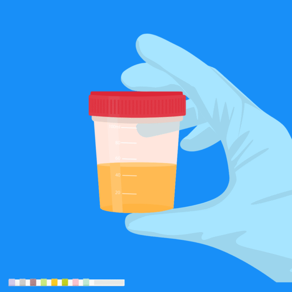 Urine test